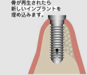 スクリーンショット 2025-12-17 5.55.54.png